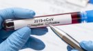 Blancafort és ara la localitat de la Conca amb més velocitat de propagació del virus