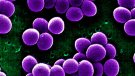 Salut Pública ha detectat al país 24 brots  d’impetigen des de principis d’any