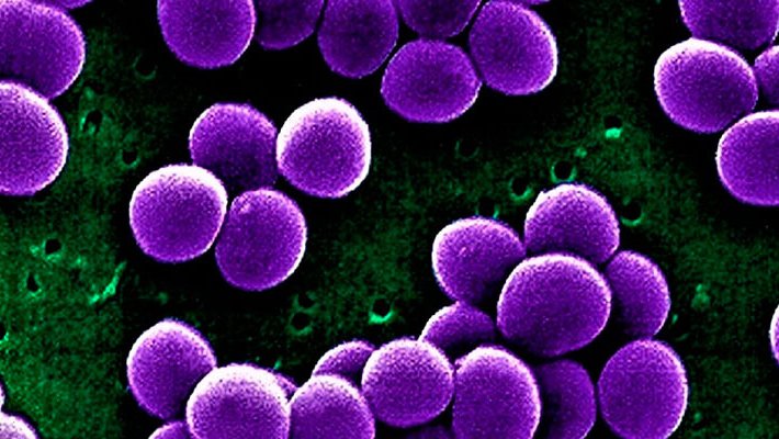 Salut Pública ha detectat al país 24 brots  d’impetigen des de principis d’any