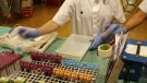 Cauen un 23% els casos de VIH diagnosticats a Catalunya durant el 2019